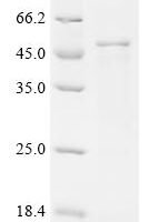 Salmonella typhimurium SPI-1 type 3 secretion system translocon protein SctB (sctB1) Recombinant Protein - BioCrest Sci