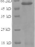 Human Angiopoietin-2 (ANGPT2), partial Recombinant Protein, N-His, aa 19–485, E.coli - BioCrest Sci