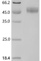 Mouse Spectrin beta chain, non-erythrocytic 1 (Sptbn1), partial Recombinant Protein, C-10His, aa 2–275 - BioCrest Sci