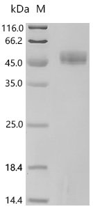Mouse Spectrin beta chain, non-erythrocytic 1 (Sptbn1), partial Recombinant Protein, C-10His, aa 2–275, Mammalian cell, C-terminal 10xHis-tagged, 38.2 kDa, purity >≥ 95% as determined by SDS-PAGE.