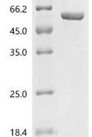 Escherichia coli Autoinducer-2 kinase (lsrK) Recombinant Protein, N-10His - BioCrest Sci