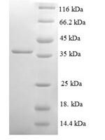 Human NADH dehydrogenase [ubiquinone] 1 alpha subcomplex subunit 3 (NDUFA3) Recombinant Protein - BioCrest Sci