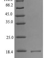 Human Low molecular weight phosphotyrosine protein phosphatase (ACP1) Recombinant Protein, Tag-Free - BioCrest Sci