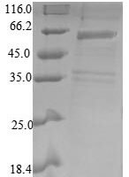 Human COP9 signalosome complex subunit 2 (COPS2) Recombinant Protein, N-His-SUMO - BioCrest Sci