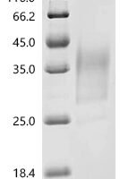 Human Seizure protein 6 homolog (SEZ6), partial Recombinant Protein, N-His-SUMO, aa 705–767 - BioCrest Sci