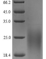 Human Secreted Ly-6/uPAR-related protein 1 (SLURP1) Recombinant Protein, N-His - BioCrest Sci