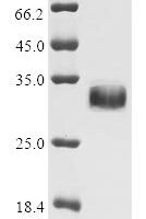 Human Notch homolog 2 N-terminal-like protein B (NOTCH2NLB) Recombinant Protein - BioCrest Sci