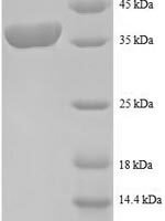 Human 40S ribosomal protein S12 (RPS12) Recombinant Protein - BioCrest Sci