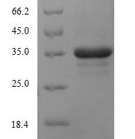 Human Cytochrome b-245 heavy chain (CYBB), partial Recombinant Protein, N-His - BioCrest Sci