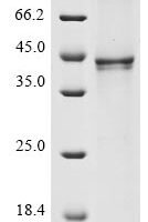Human Fibroblast growth factor 8 (FGF8), partial Recombinant Protein - BioCrest Sci