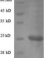 Helicobacter pylori Vacuolating cytotoxin autotransporter (vacA), partial Recombinant Protein, N-His - BioCrest Sci