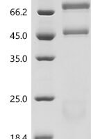 Bovine Coagulation factor X (F10) Recombinant Protein - BioCrest Sci