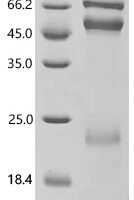 Human Coagulation factor X (F10) Recombinant Protein - BioCrest Sci