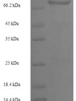 Mouse Transcriptional repressor CTCFL (Ctcfl) Recombinant Protein, N-His-SUMO - BioCrest Sci