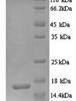 Human Glutamate receptor 3 (GRIA3), partial Recombinant Protein - BioCrest Sci
