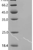 Mouse Insulin-like growth factor I (Igf1) Recombinant Protein - BioCrest Sci