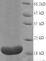 Human Interleukin-18-binding protein (IL18BP), partial Recombinant Protein - BioCrest Sci
