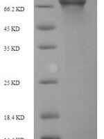 Rat Putative phospholipase B-like 2 (Plbd2) Recombinant Protein, N-His-SUMO - BioCrest Sci