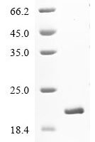 Human Microtubule-associated proteins 1A/1B light chain 3B (MAP1LC3B) Recombinant Protein - BioCrest Sci