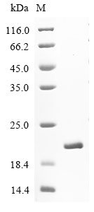 Human Microtubule-associated proteins 1A/1B light chain 3B (MAP1LC3B) Recombinant Protein, Homo sapiens (Human), E.coli, N-terminal 6xHis-tagged, 18.2 kDa, purity >≥ 90% as determined by SDS-PAGE.