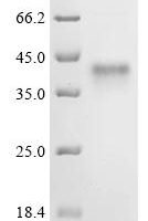 Vaccinia virus Soluble interferon gamma receptor OPG193 (OPG193) Recombinant Protein, C-10His - BioCrest Sci