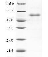 Human Regulator of G-protein signaling 20 (RGS20) Recombinant Protein - BioCrest Sci