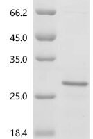 Mouse Interleukin-2 (Il2) Recombinant Protein, N-His - BioCrest Sci