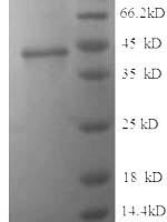 Human Junctional adhesion molecule B (JAM2), partial Recombinant Protein, N-His, aa 29–238, E.coli - BioCrest Sci