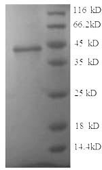 Human Junctional adhesion molecule B (JAM2), partial Recombinant Protein, N-His, aa 29–238, E.coli, Homo sapiens (Human), E.coli, N-terminal 6xHis-tagged, 27.5 kDa, purity >≥ 90% as determined by SDS-PAGE.