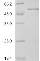 Human Formin-2 (FMN2), partial Recombinant Protein, C-His - BioCrest Sci