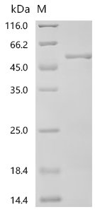 Human Formin-2 (FMN2), partial Recombinant Protein, C-His, Homo sapiens (Human), E.coli, C-terminal 6xHis-tagged, 51.9 kDa, purity >≥ 85% as determined by SDS-PAGE.