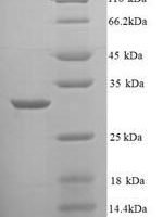 Mycobacterium tuberculosis Enoyl-[acyl-carrier-protein] reductase [NADH] (inhA) Recombinant Protein - BioCrest Sci
