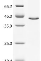 Human Protein Wnt-3a (WNT3A), partial Recombinant Protein, C-His - BioCrest Sci