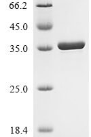 Drosophila melanogaster Spectrin beta chain (beta-Spec), partial Recombinant Protein - BioCrest Sci