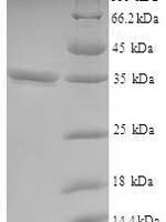 Human V-set and transmembrane domain-containing protein 2-like protein (VSTM2L) Recombinant Protein - BioCrest Sci