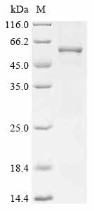 Rat Muscle, skeletal receptor tyrosine protein kinase (Musk), partial Recombinant Protein, Rattus norvegicus (Rat), E.coli, N-terminal 6xHis-tagged, 56.0 kDa, purity >≥ 85% as determined by SDS-PAGE.