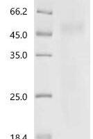 Human Collagen alpha-1 (XVIII) chain (COL18A1), partial Recombinant Protein, N-His - BioCrest Sci