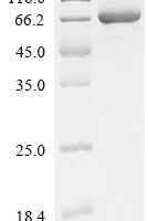 Escherichia coli Lysine--tRNA ligase (lysS) Recombinant Protein - BioCrest Sci