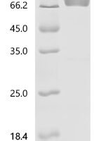 Human Fibroblast growth factor receptor 2 (FGFR2), partial Recombinant Protein - BioCrest Sci