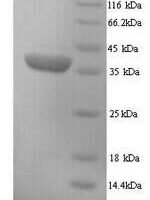 Mouse H-2 class I histocompatibility antigen, D-D alpha chain (H2-D1), partial Recombinant Protein - BioCrest Sci