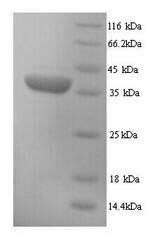Mouse H-2 class I histocompatibility antigen, D-D alpha chain (H2-D1), partial Recombinant Protein, Mus musculus (Mouse), Yeast, N-terminal 6xHis-tagged, 35.2 kDa, purity >≥ 90% as determined by SDS-PAGE.