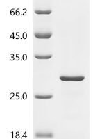 Human Immunoglobulin J chain (JCHAIN) Recombinant Protein, C-His, aa 23–159, E.coli - BioCrest Sci