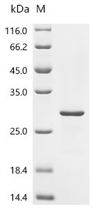 Human Immunoglobulin J chain (JCHAIN) Recombinant Protein, C-His, aa 23–159, E.coli, Homo sapiens (Human), E.coli, C-terminal 6xHis-tagged, 22.5 kDa, purity >≥ 90% as determined by SDS-PAGE.