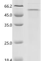 Human herpesvirus 1 Capsid vertex component 1 (CVC1), partial Recombinant Protein - BioCrest Sci