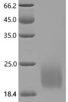 Mouse Tumor necrosis factor receptor superfamily member 13C (Tnfrsf13c), partial Recombinant Protein - BioCrest Sci