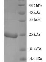 Ustilago maydis P6 virus KP6 killer toxin, partial Recombinant Protein - BioCrest Sci