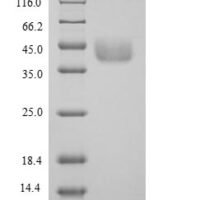 Mouse Serine--pyruvate aminotransferase, mitochondrial (Agxt) Recombinant Protein, N-His - BioCrest Sci