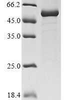 Bovine Pigment epithelium-derived factor (SERPINF1) Recombinant Protein - BioCrest Sci