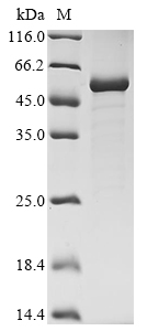 Bovine Pigment epithelium-derived factor (SERPINF1) Recombinant Protein, Bos taurus (Bovine), E.coli, N-terminal 10xHis-tagged and C-terminal Myc-tagged, 51.5 kDa, purity >≥ 85% as determined by SDS-PAGE.