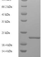 Carpinus betulus Major pollen allergen Car b 1 isoforms 1A and 1B Recombinant Protein - BioCrest Sci